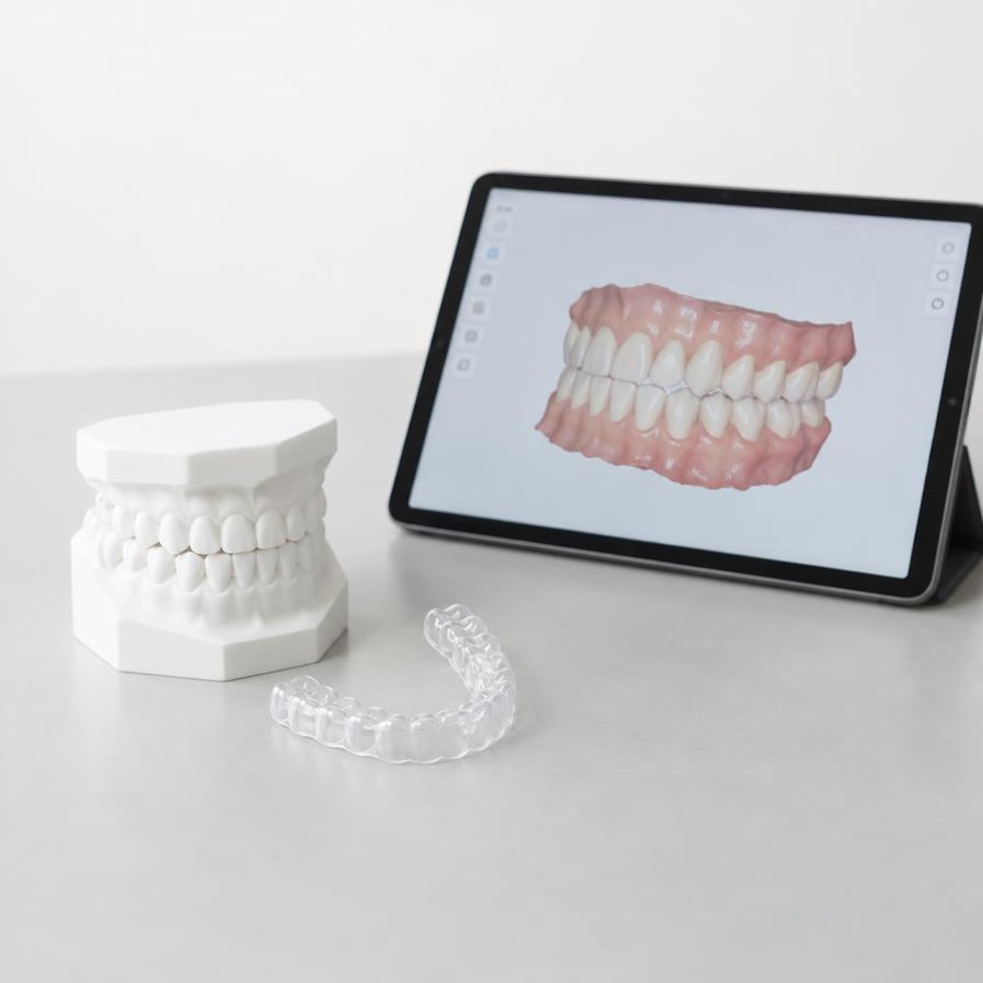 Communication — Planet Ortho International Digital scan review beside a physical model